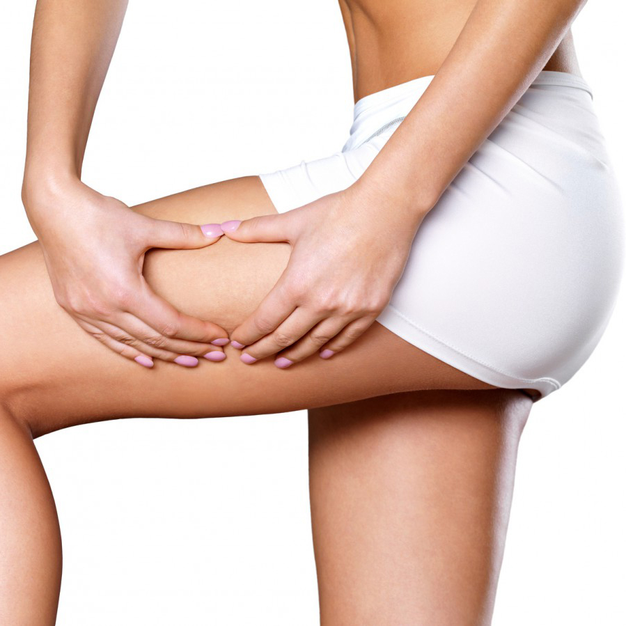 cellulite-01-e1444464975742